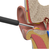 Ecliptic Sharp™ Intelligent Ear Wax Removal